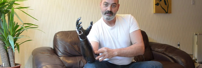prothese-bras-main-robotise-video
